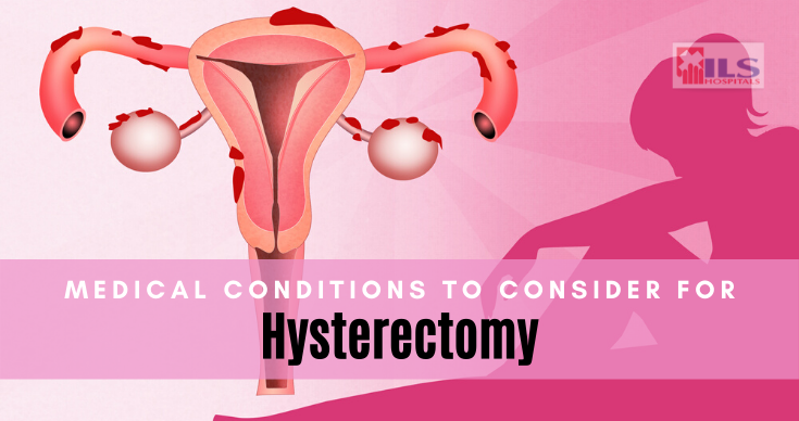 Hysterectomy