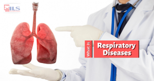 Do You Know These 4 Common Respiratory Diseases? Know Now