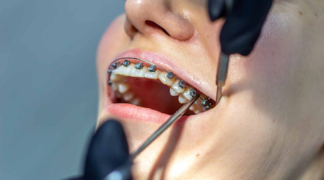 Treatment of orthodontic problems
